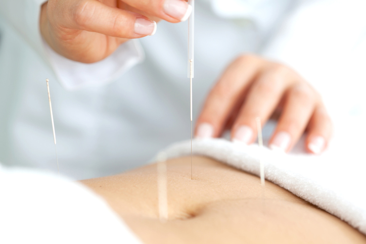 Acupuncture and Fertility: What You Need to Know