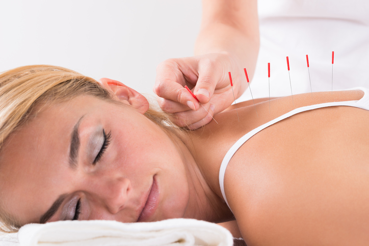 Need a productivity boost? Try acupuncture