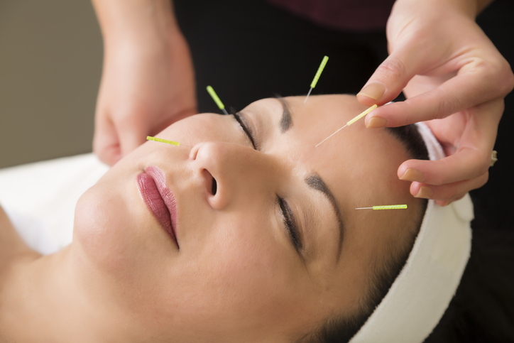 Mature woman getting acupuncture treatment at the spa