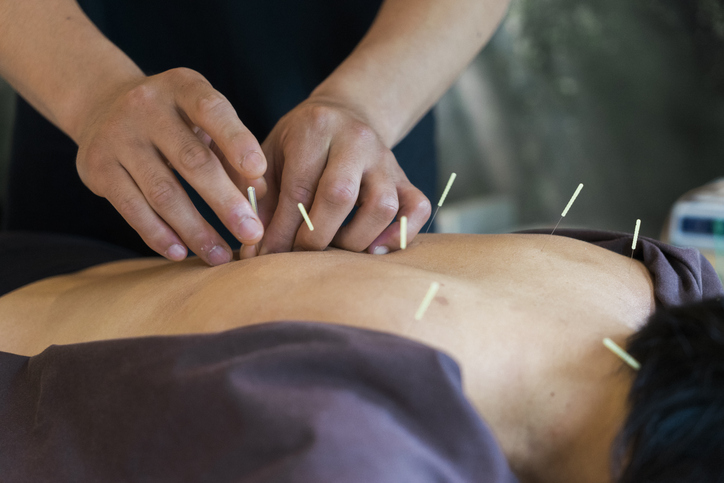 Understanding acupuncture: Treatment for insomnia and anxiety